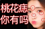 有桃花劫的痣怎么办